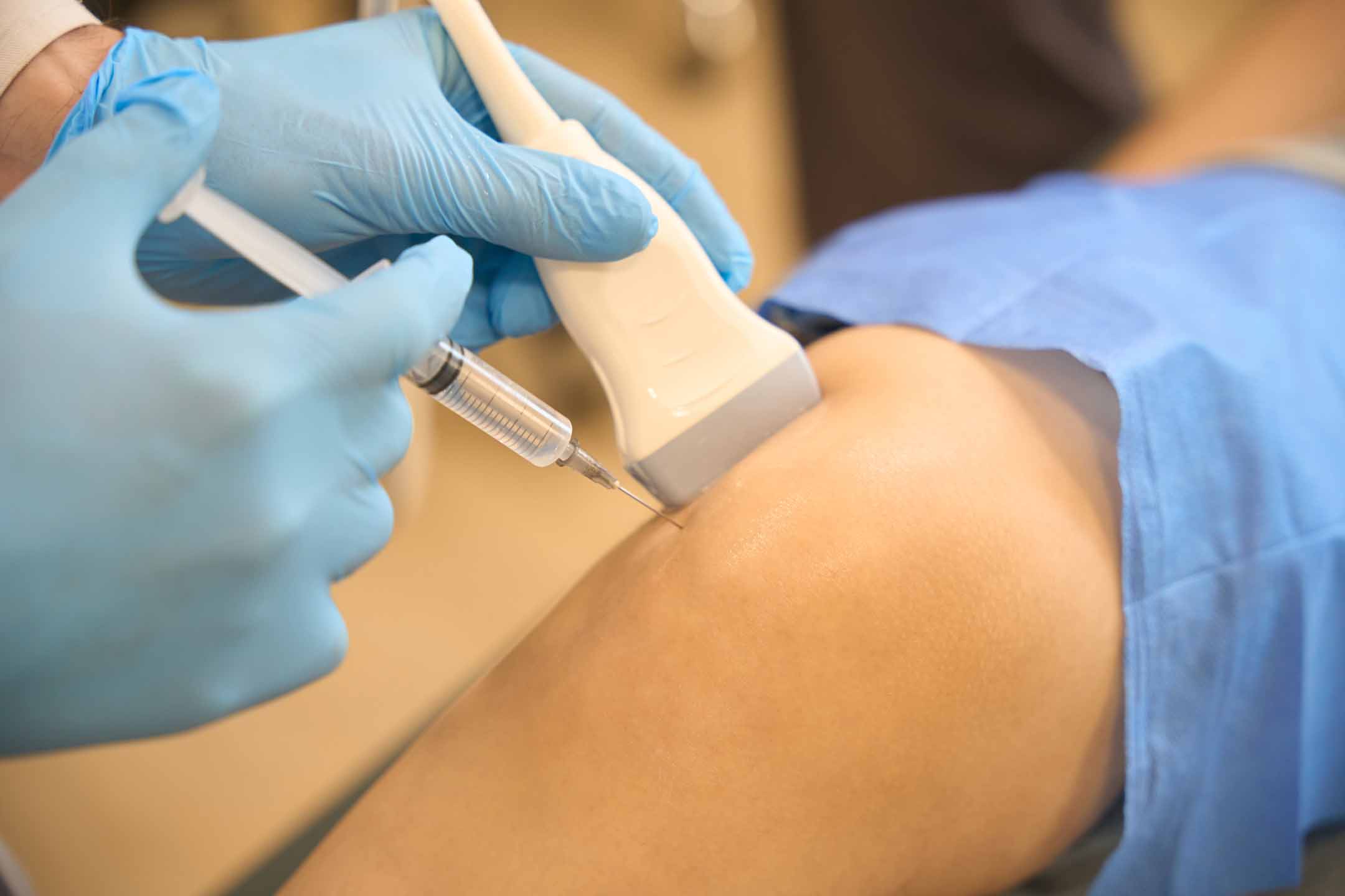 Arthrocentesis